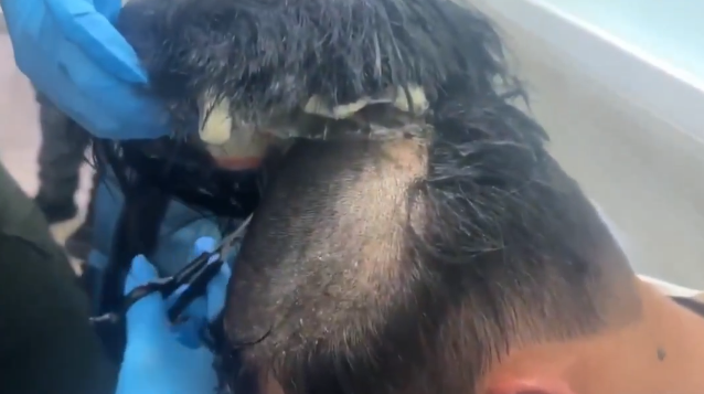 VÍDEO: Polícia da Colômbia prende homem que traficava cocaína debaixo de ‘narcoperuca’