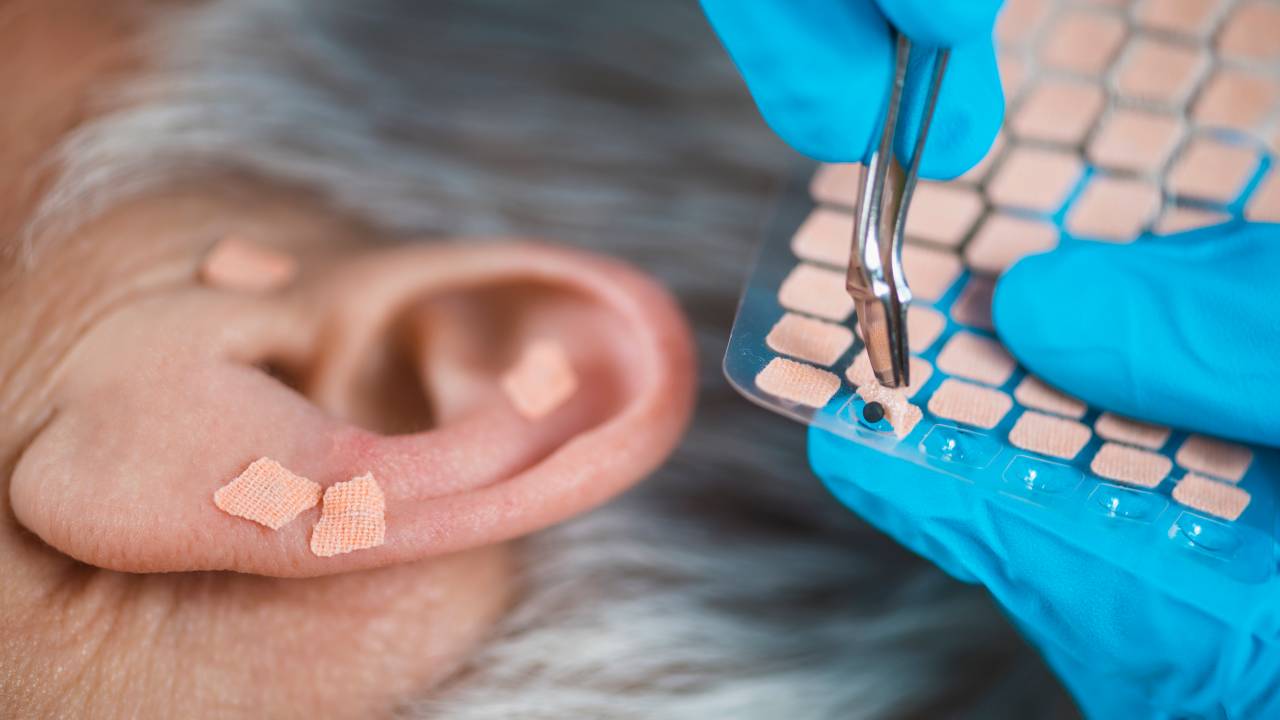 AURICULOTERAPIA - Práticas complementares: falta de comprovação científica