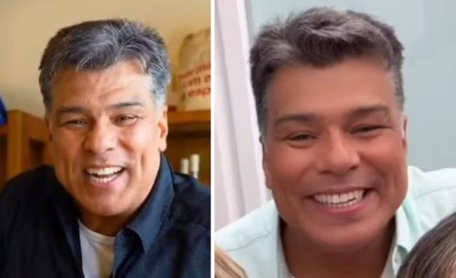 mauricio-mattar Antes e depois da harmonização facial de Maurício Mattar