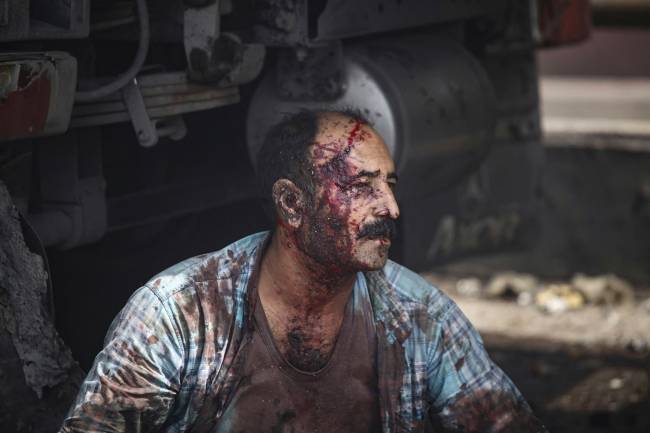 IRAN-PORT-EXPLOSION EDITORS NOTE: Graphic content / An injured man sits on the ground along a highway near the source of an explosion at the Shahid Rajaee port dock southwest of Bandar Abbas in the Iranian province of Hormozgan on April 26, 2025. Several containers exploded on April 26 at Iran's largest commercial port, authorities said, causing a major blast and fire, and leaving hundreds injured. Shahid Rajaee, more than 1,000 kilometres (620 miles) south of the capital, is the most advanced container port in Iran, according to the official IRNA news agency. (Photo by MOHAMMAD RASOLE MORADI / IRNA / AFP)