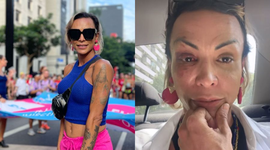 A ativista trans Iza Potter antes e depois da agressão que sofreu dentro do próprio condomínio na madrugada desta terça, 15