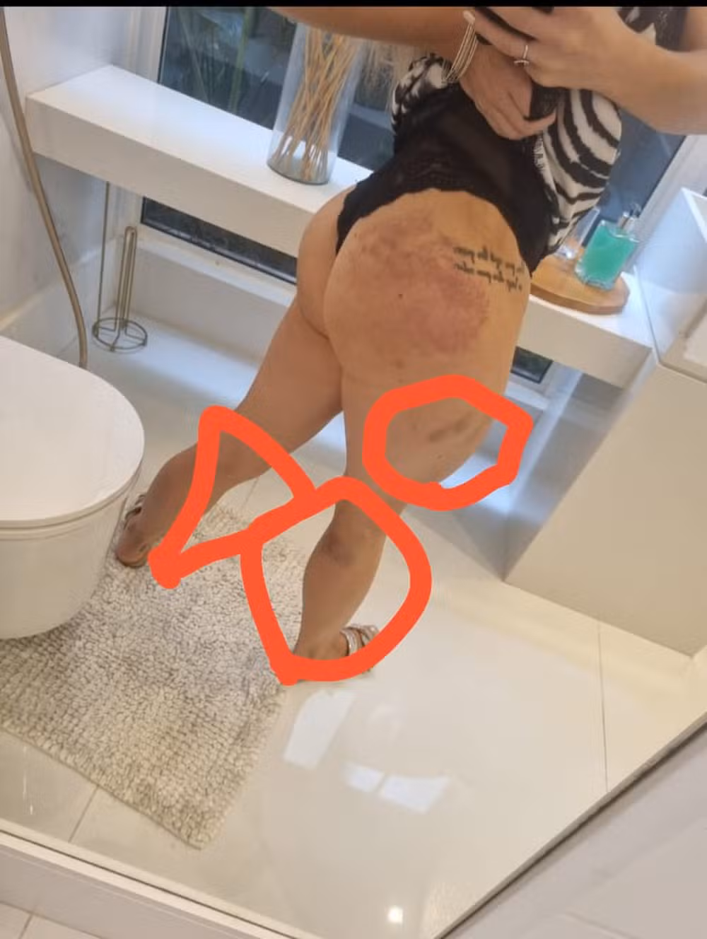 Larissa anexou imagens como prova da violência