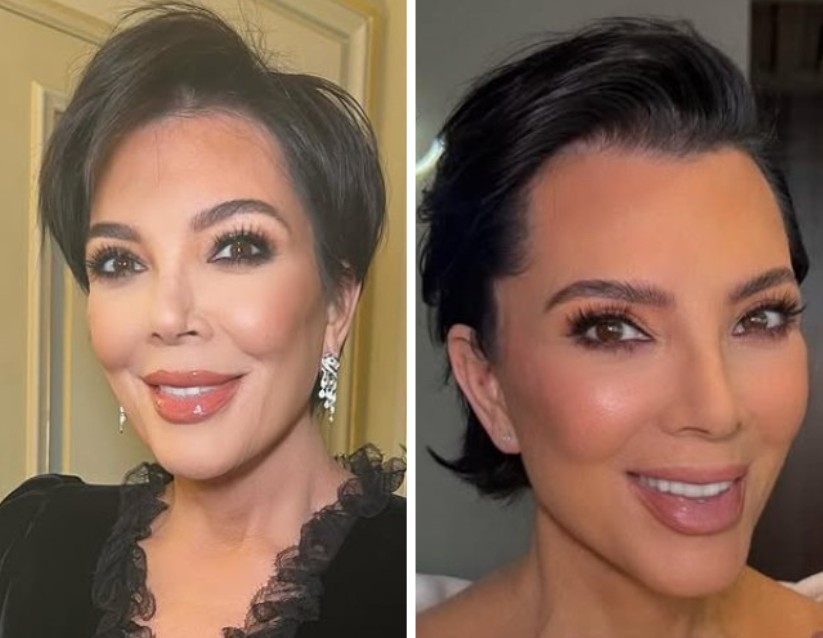 O que está por trás do ‘rejuvenescimento’ de Kris Jenner