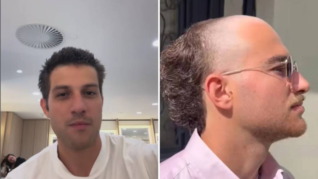 A moda dos calvos: tendência que vai contra homens ‘penteados’