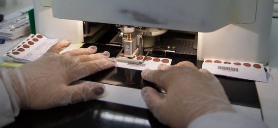 Nova estratégia inclui Correios para agilizar entrega do ‘teste do pezinho’