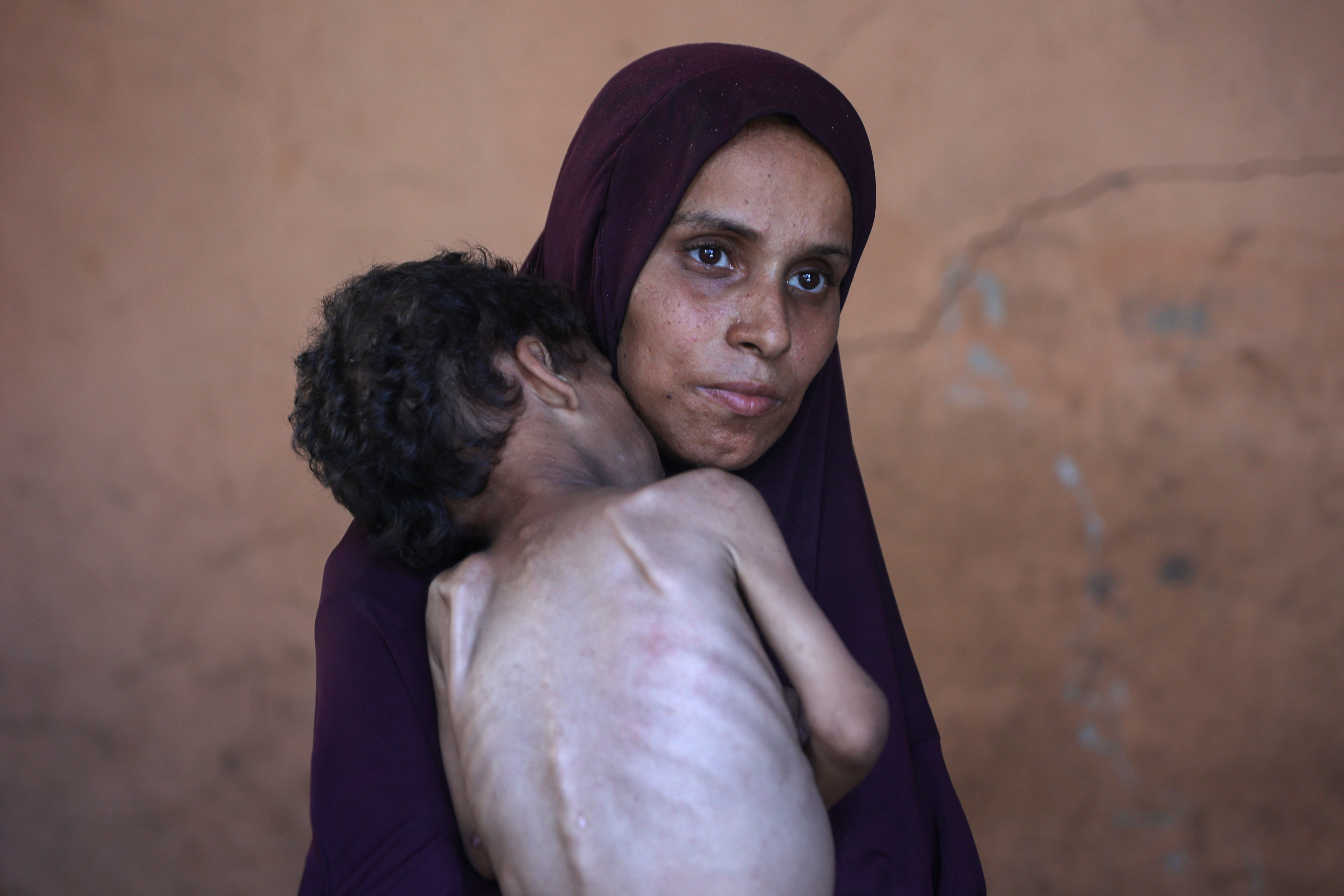 Quase 55 mil crianças enfrentam desnutrição aguda em Gaza, mostra estudo da ONU