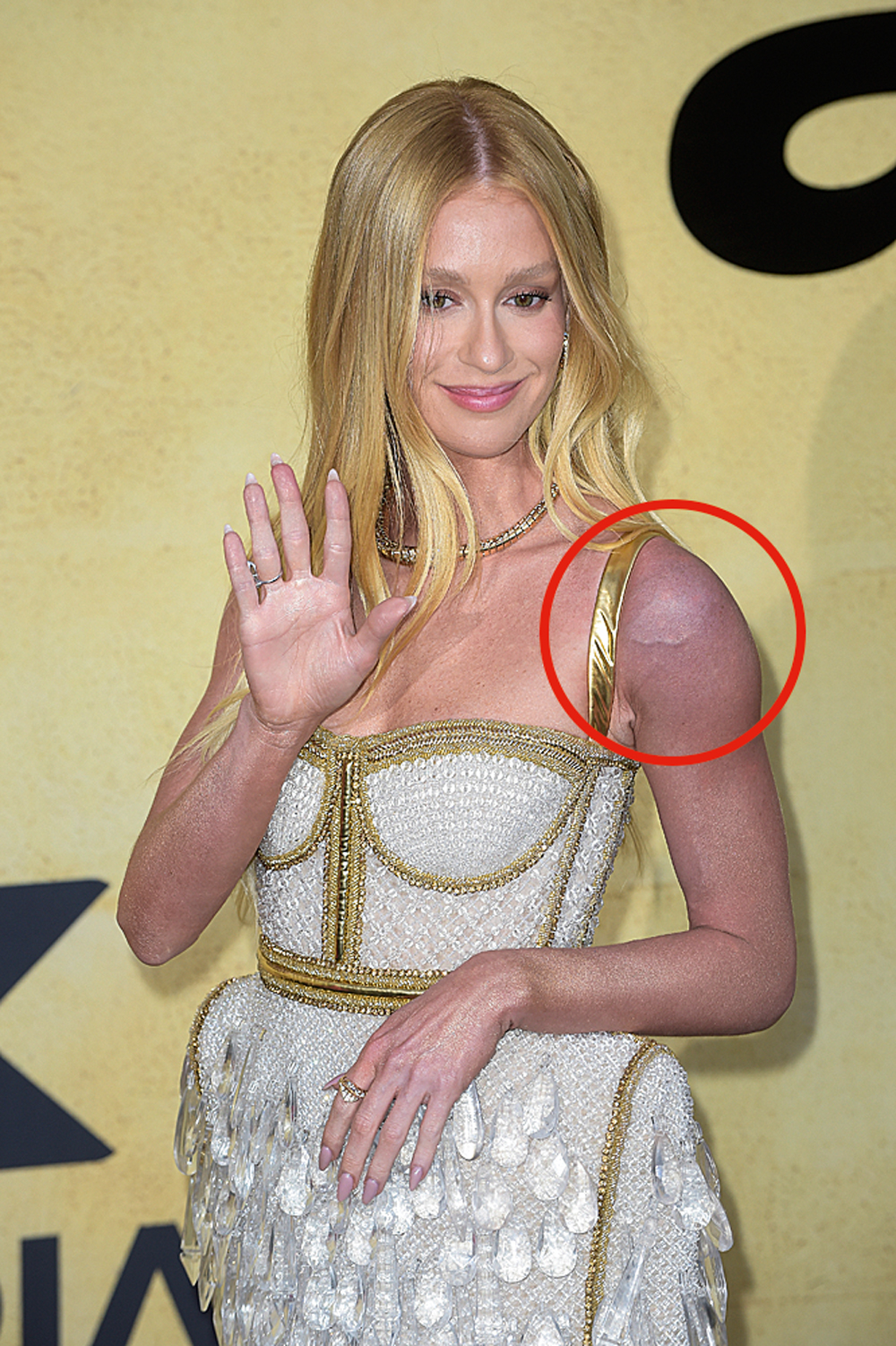 HEMATOMA -&ensp;Marina Ruy Barbosa em Cannes: vestido de 15 quilos deixou a atriz brasileira com o ombro roxo