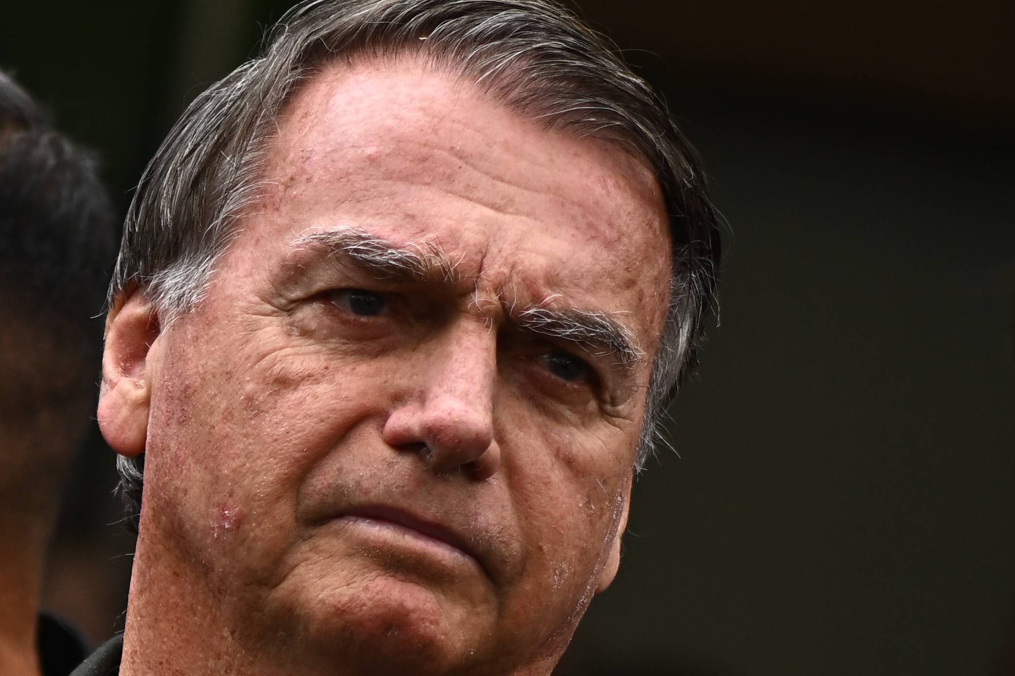 Bolsonaro tem melhora em quadro de soluços e deve receber alta amanhã, dizem médicos