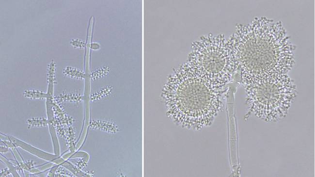 Fotos de microscopia, com aumento de 40 vezes, mostram conidióforo com as vesículas cilíndricas da espécie Escovopsis weberi, mais eficientes na reprodução assexuada (à esq.) e vesículas globosas de Escovopsis papillata (dir.), espécie mais próxima do ancestral comum do gênero e menos eficiente nesse tipo de reprodução Fotos de microscopia, com aumento de 40 vezes, mostram conidióforo com as vesículas cilíndricas da espécie Escovopsis weberi, mais eficientes na reprodução assexuada (à esq.) e vesículas globosas de Escovopsis papillata (dir.), espécie mais próxima do ancestral comum do gênero e menos eficiente nesse tipo de reprodução