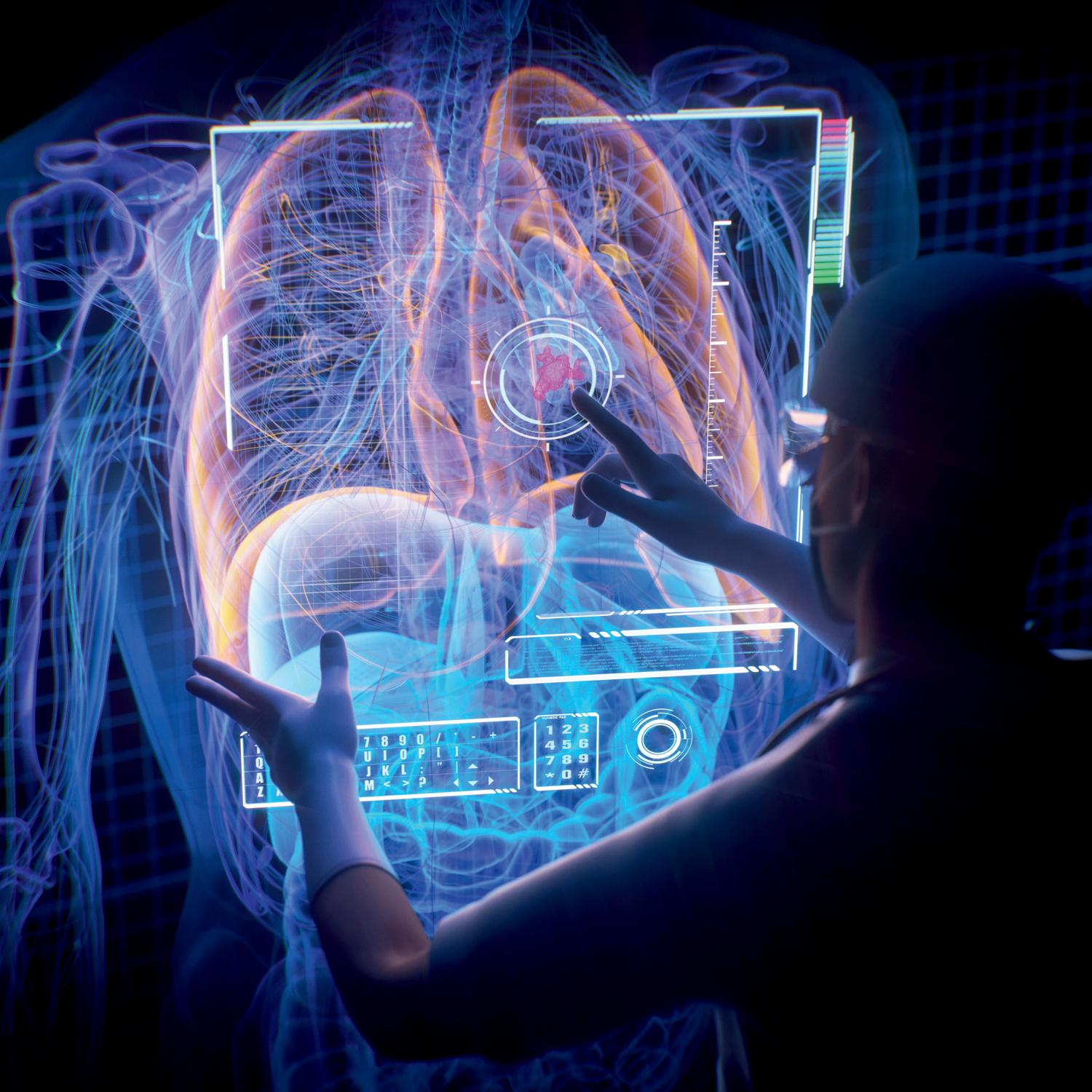 PIONEIRISMO - Exames de imagem: na vanguarda da an&aacute;lise por computador