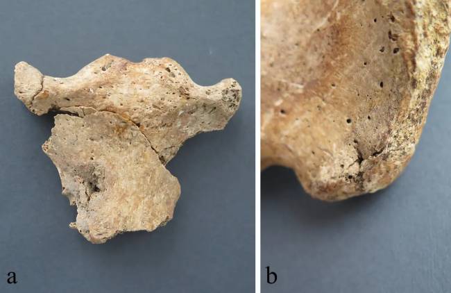 ferimentos ossos soldados romanos