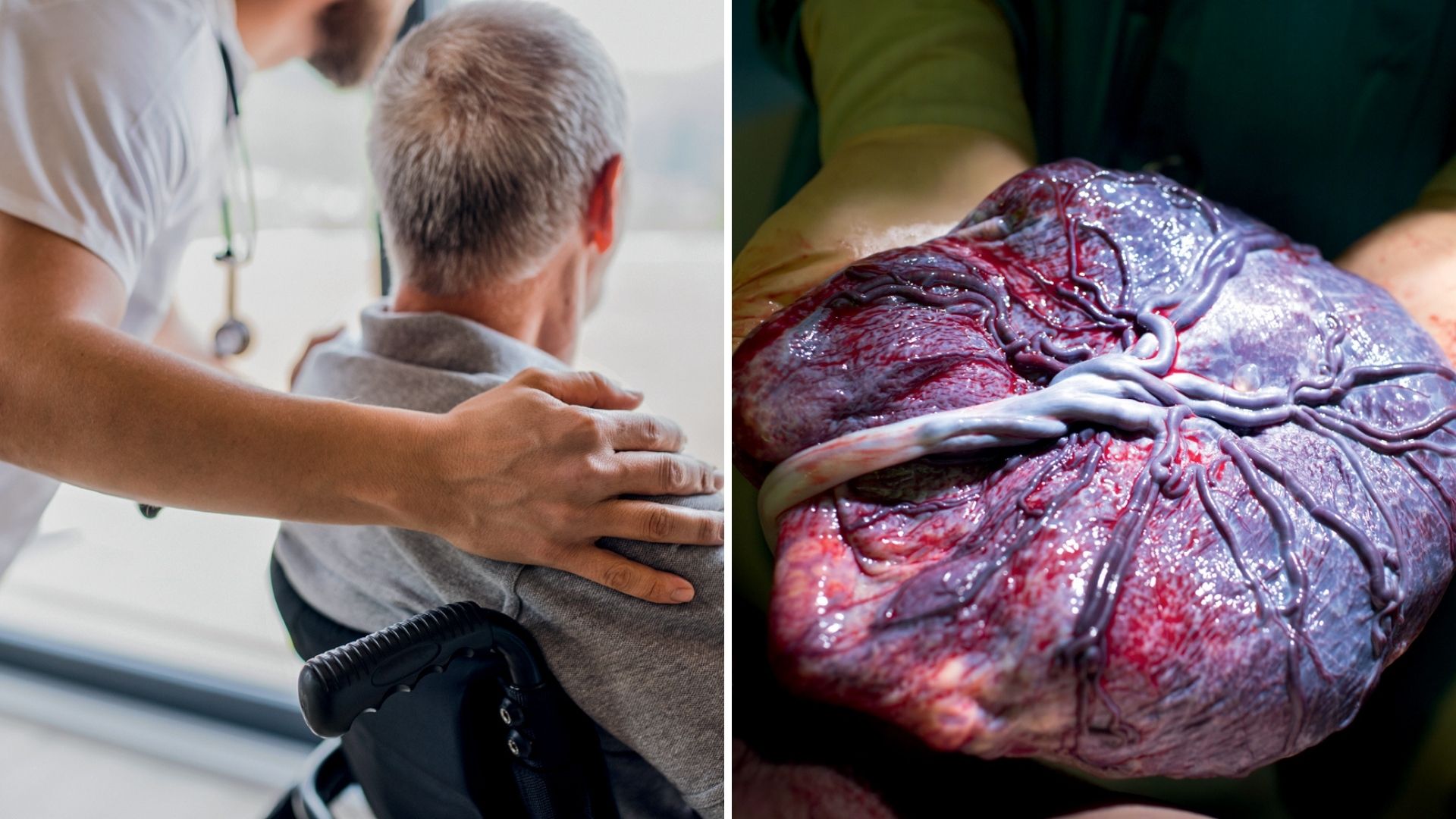 REGENERA&Ccedil;&Atilde;O -&ensp;Da placenta ao paciente: Anvisa acaba de autorizar estudos cl&iacute;nicos