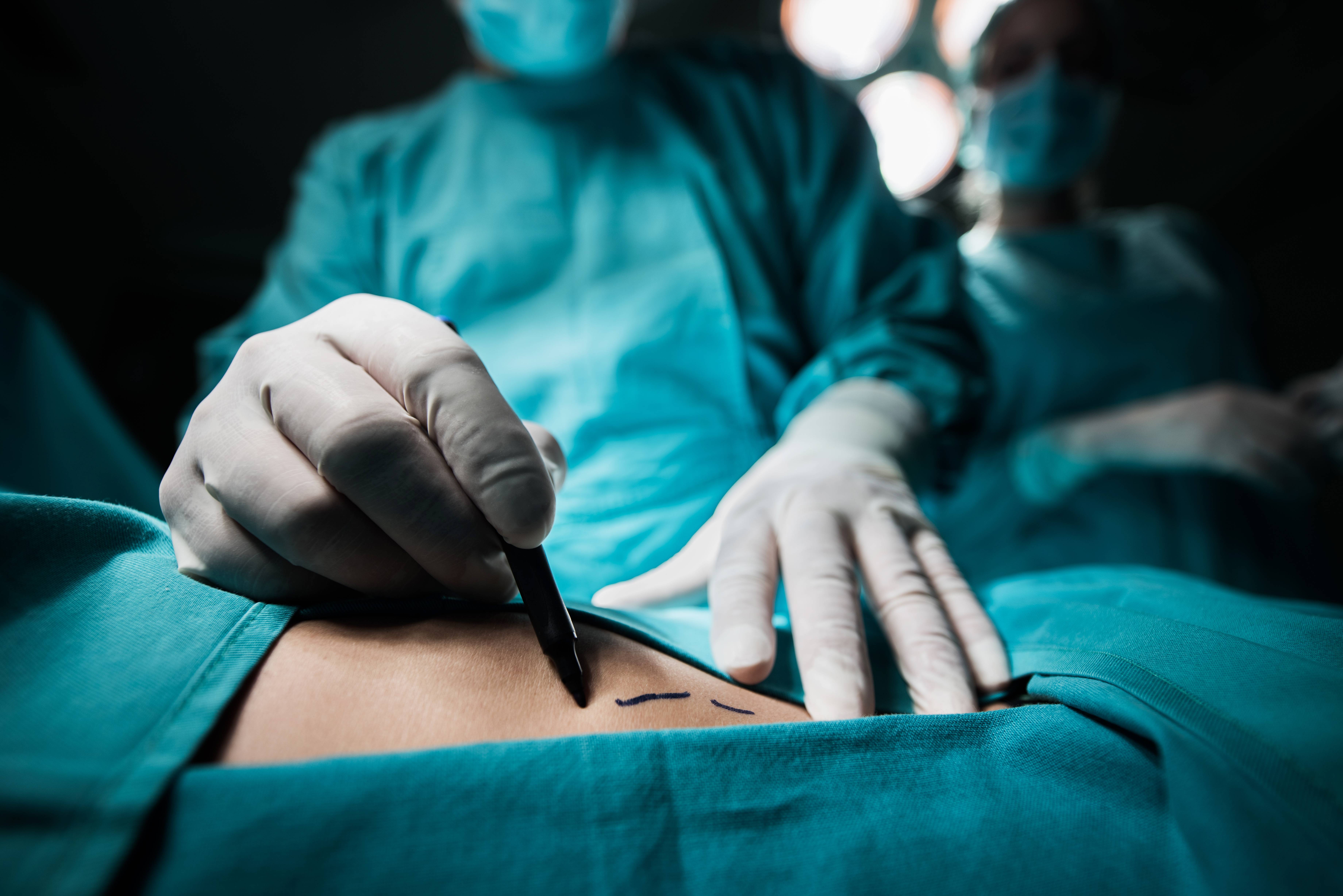 Lipoaspiração que terminou em morte de empresária foi feita por médico sem especialização exigida