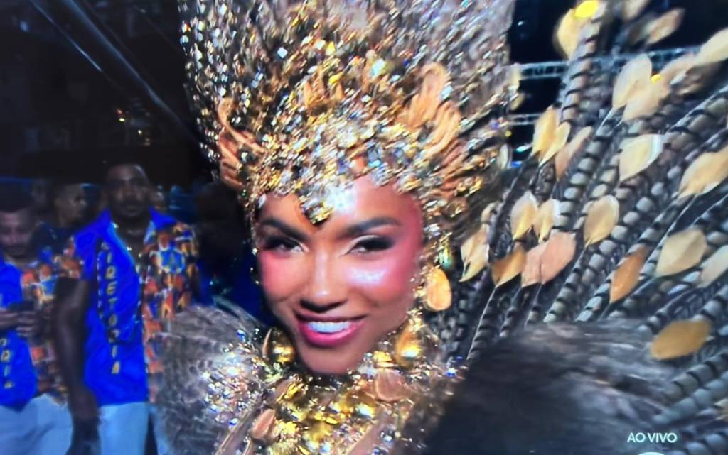 A rainha que não teme assumir seus procedimentos estéticos