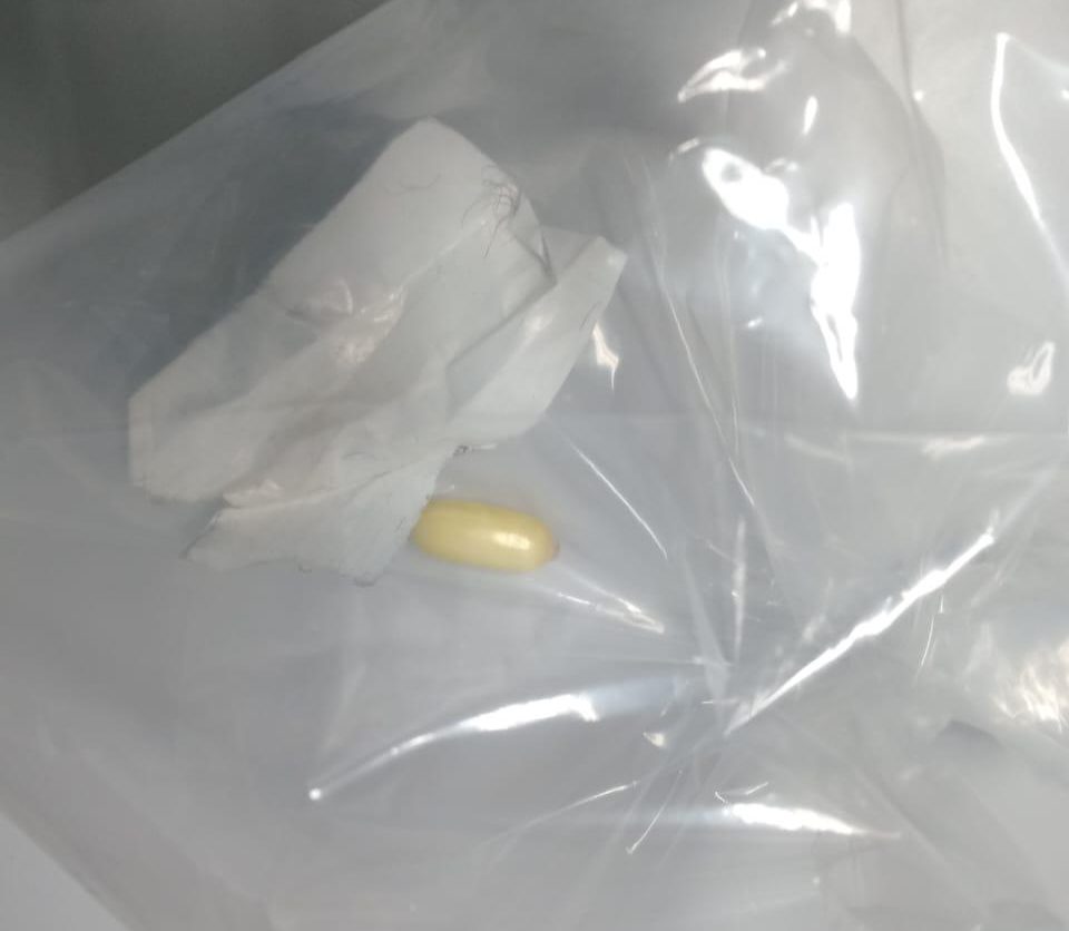 Capsulas de coca&iacute;na ingeridas por homem que foi preso no Aeroporto do Gale&atilde;o (15/03/2026)