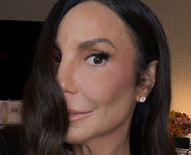 Ivete Sangalo expõe sensação após queda e cirurgia no rosto