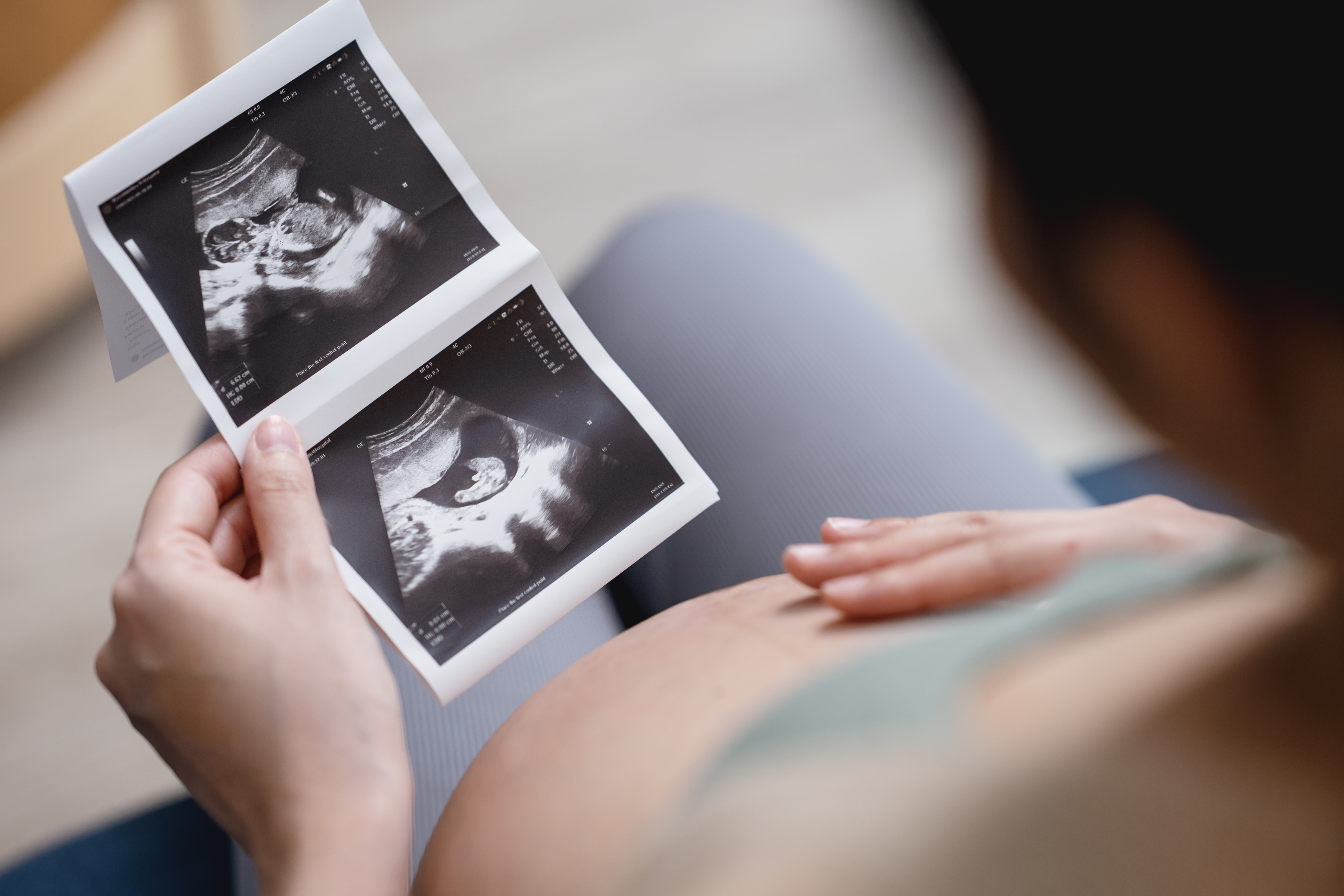 Uma em cada cinco gestantes não completa o mínimo de consultas do pré-natal no Brasil