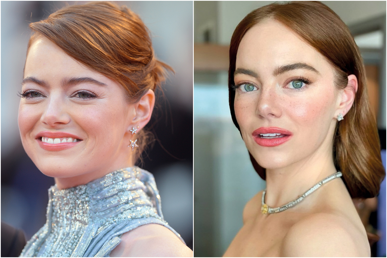 SER&Aacute; QUE FEZ?&ensp;- A atriz Emma Stone, 37 anos: ela n&atilde;o confirmou, mas especulam que teria feito uma esp&eacute;cie de tratamento preventivo