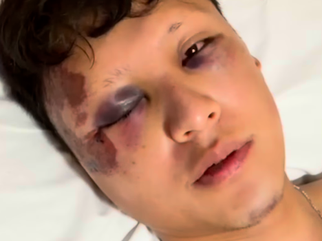 Turista mexicano sofre traumatismo craniano em assalto violento na orla de Copacabana
