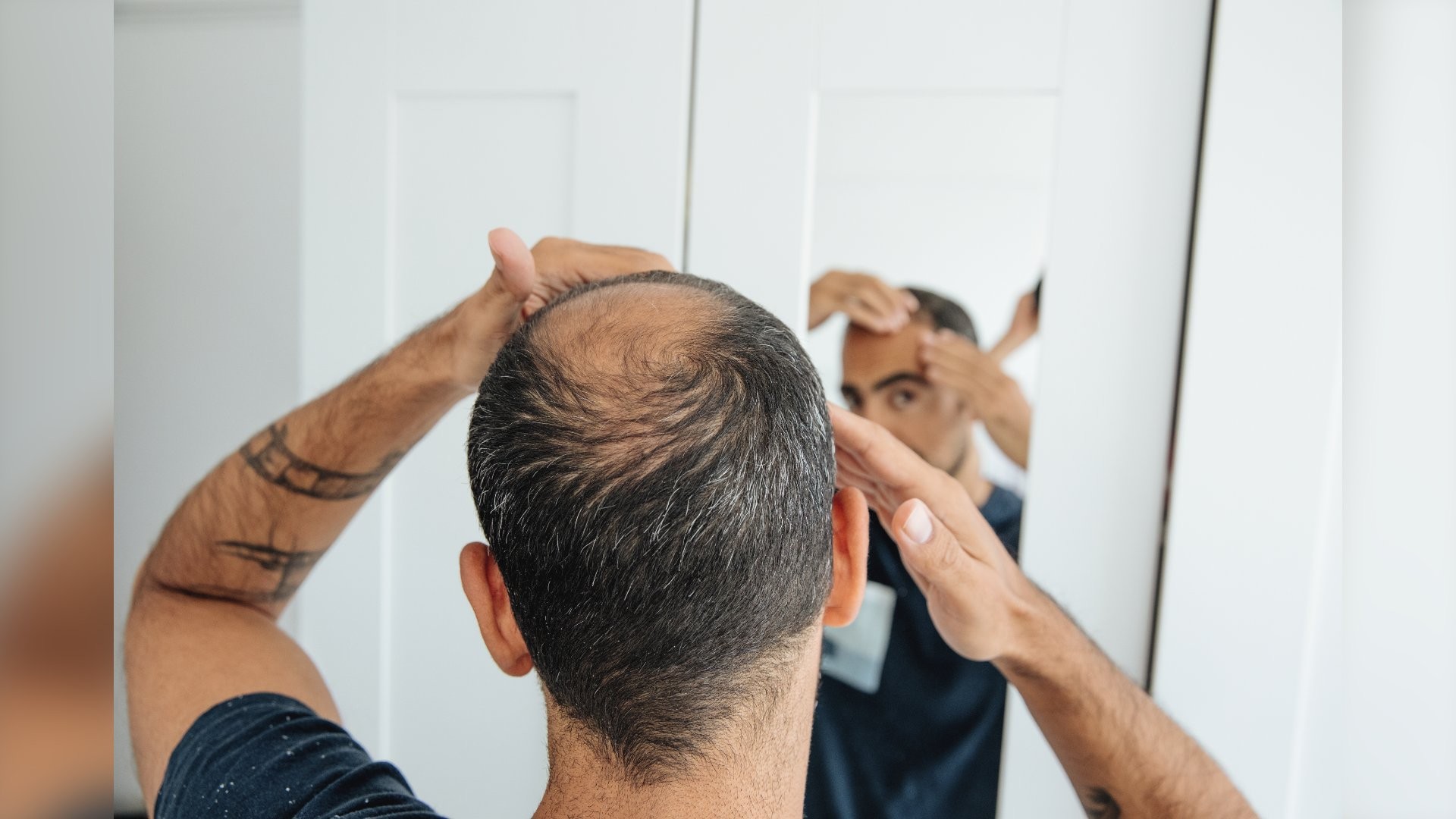 Tratamento da queda de cabelo avança com métodos de estimulação cada vez mais precisos e eficazes